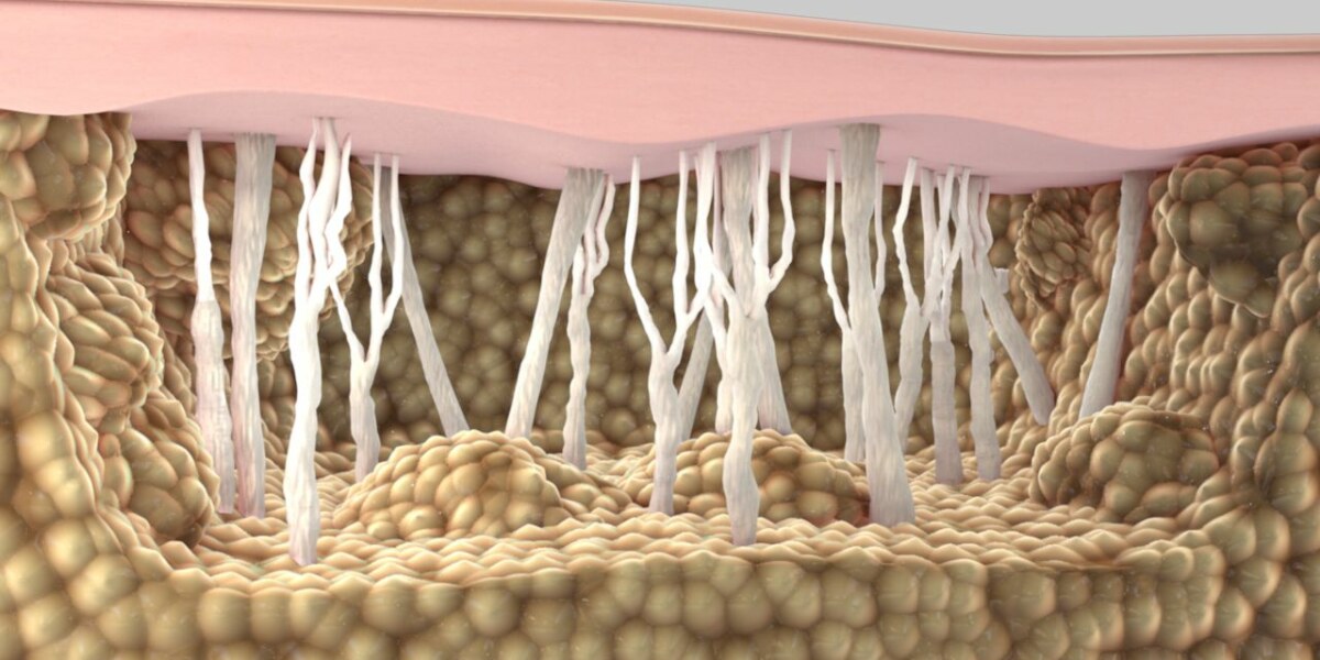 Подкожни мазнини | Описание и уелнес решения