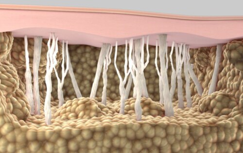 Подкожни мазнини | Описание и уелнес решения