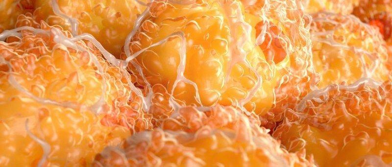 Висцерални мазнини | Описание и уелнес решения